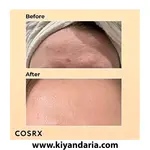 ست مراقبت از پوست حلزون برند Cosrx مدل Advanced Snail 96 Mucin Power Essence. نمای کلی
