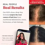 کپسول‌ های ویتامین بیوتین رشد مو برند HAIRtamin نمی نتیجه محصول