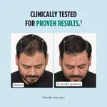 مکمل رشد موی Nutrafol مخصوص آقایان نمای نتیجه محصول
